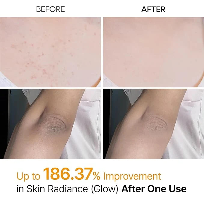 Dr. Melaxin Peel Shot Kojic Acid & Turmeric Spray – 200ml